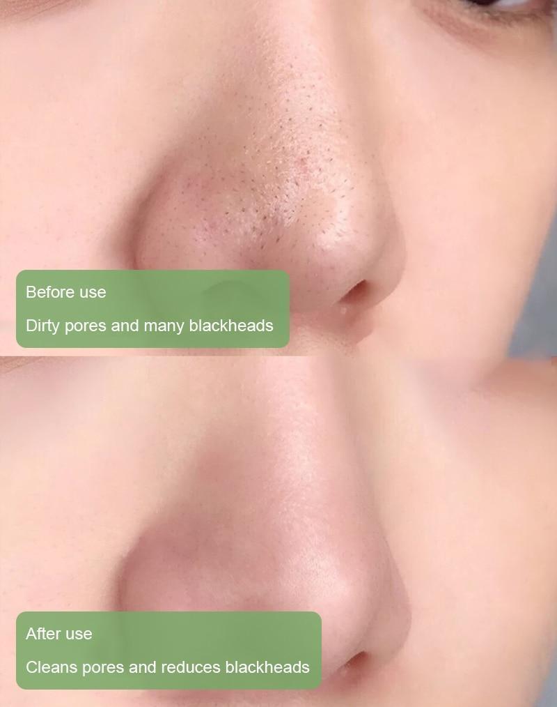 (BUY 1  GET 2) Diystar™  Green Tea Deep Cleanse Mask Stick