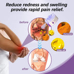 ™ Turmeric & Emu Oil Arthritis Soothing Pain Relief Massage Gel