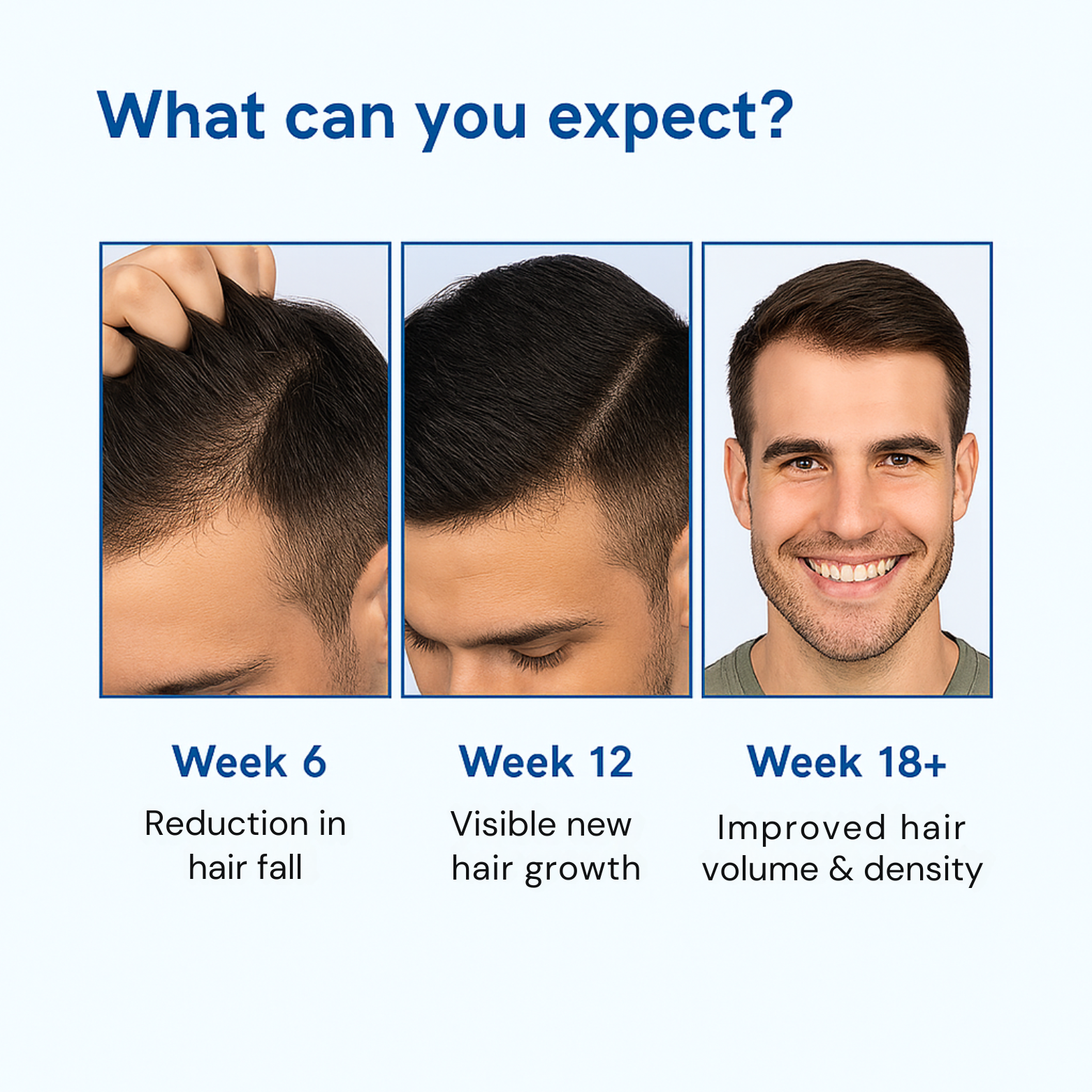 (BUY 1 GET 2) Hair Growth Roll On