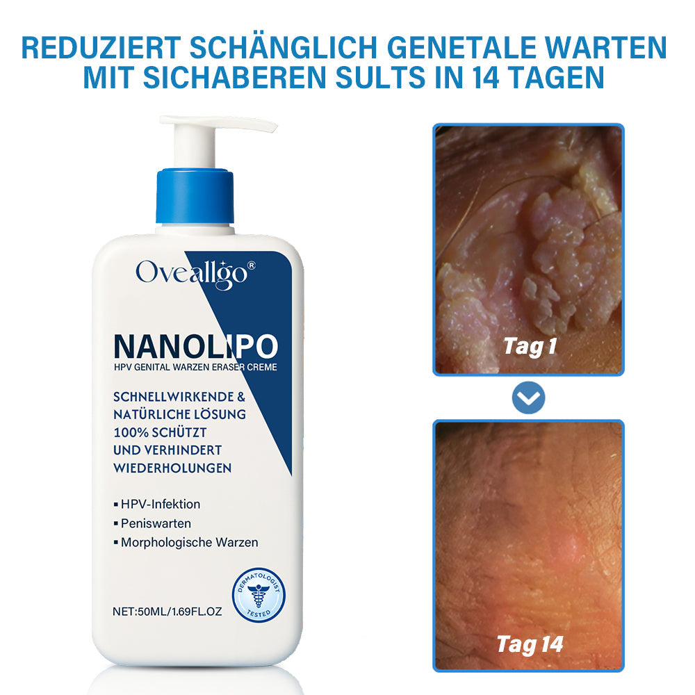 Oveallgo® NanoLipo Genital warzen-Eraser creme Promax
