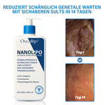 Oveallgo® NanoLipo Genital warzen-Eraser creme Promax