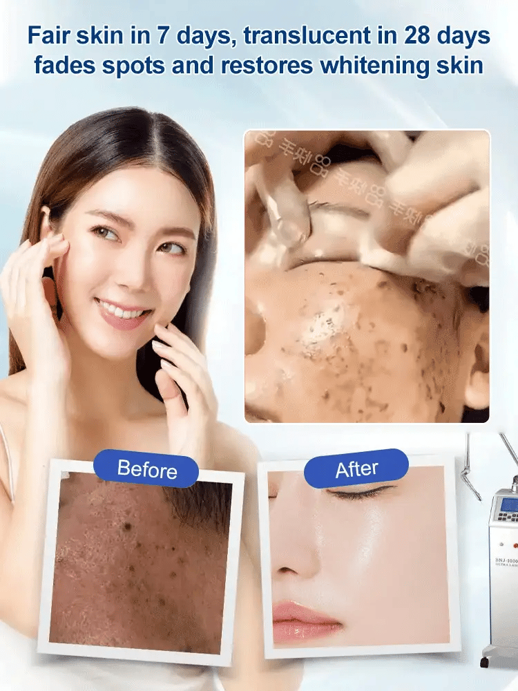 (BUY 1 GET 2) Spot Fading Urea Cream