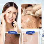 (BUY 1 GET 2) Spot Fading Urea Cream