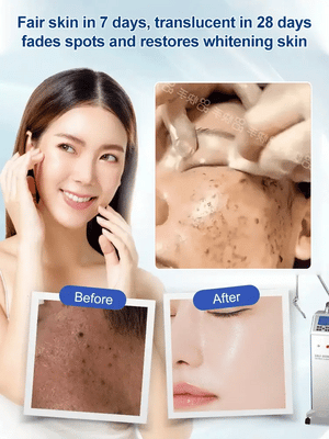(BUY 1 GET 2) Spot Fading Urea Cream
