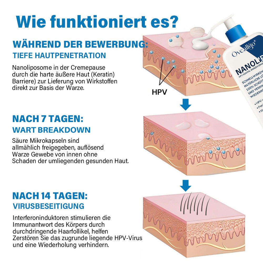 Oveallgo® NanoLipo Genital warzen-Eraser creme Promax