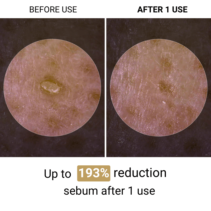 (BUY 1 GET 2) Lumora Melaxin™ | Korean Peeling Ampoule
