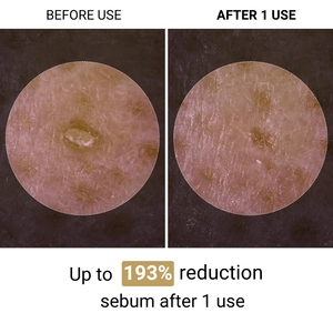 (BUY 1 GET 2) Lumora Melaxin™ | Korean Peeling Ampoule