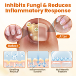 Timilk® FungiBee Advanced Nail Repair Spray shop