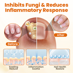 Timilk® FungiBee Advanced Nail Repair Spray shop