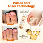Timilk® FungiBee Advanced Nail Repair Spray shop