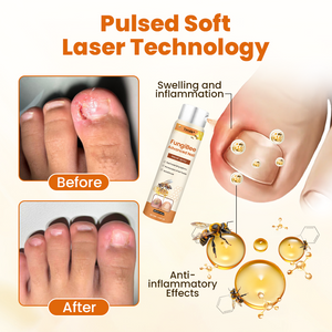 Timilk® FungiBee Advanced Nail Repair Spray shop