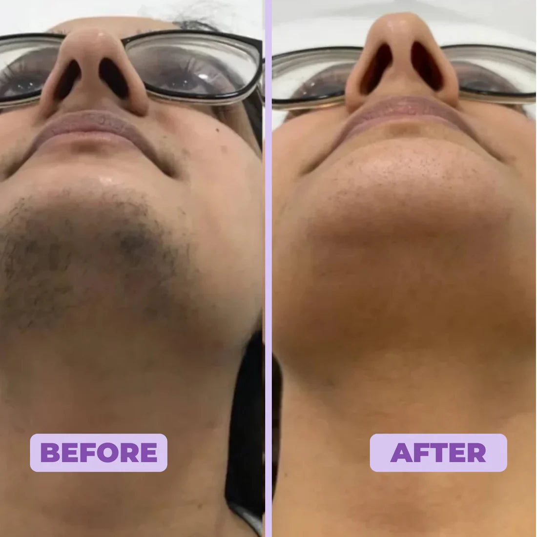 Nurea™ Facial Hair Removal Cream