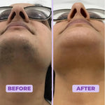 Nurea™ Facial Hair Removal Cream