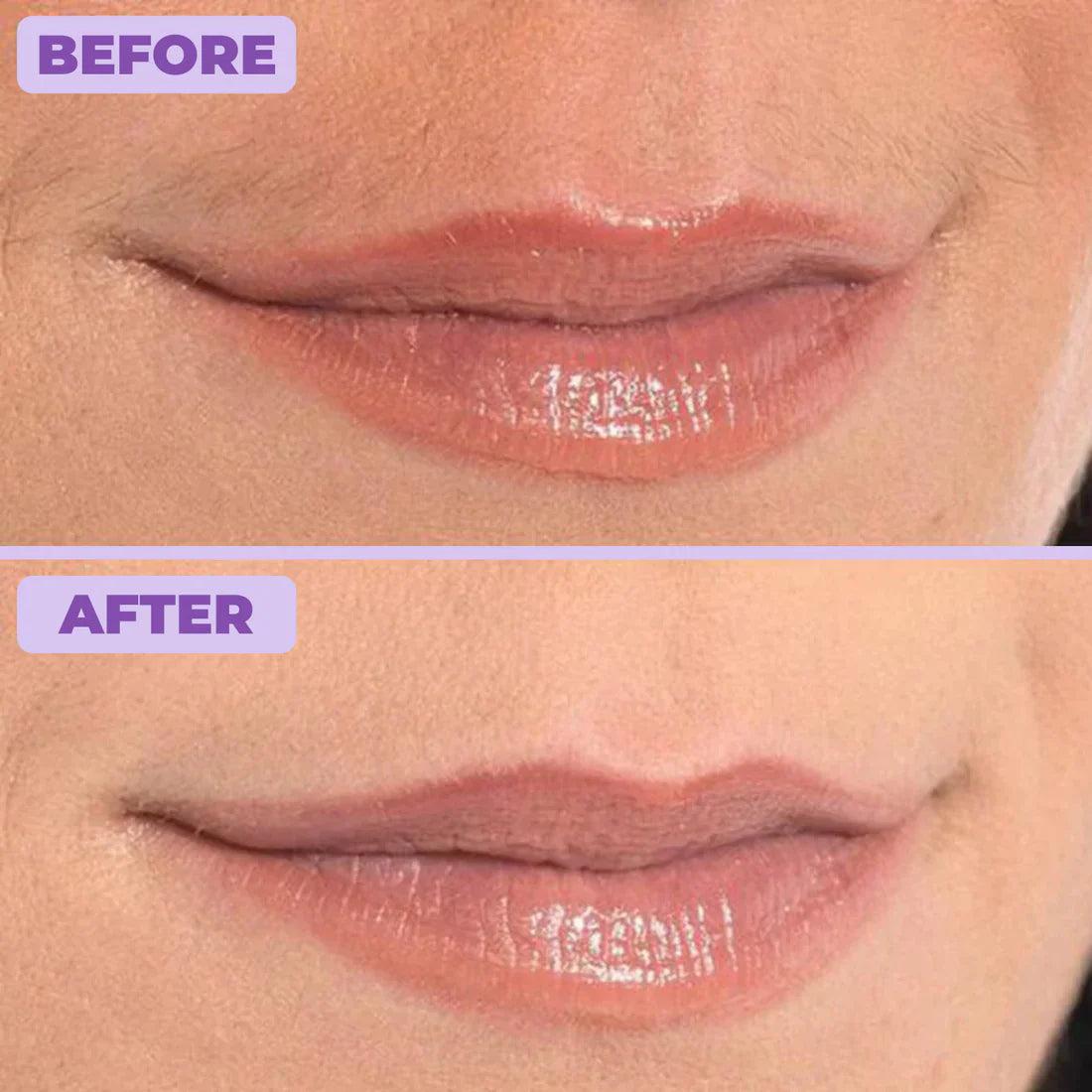 Nurea™ Facial Hair Removal Cream