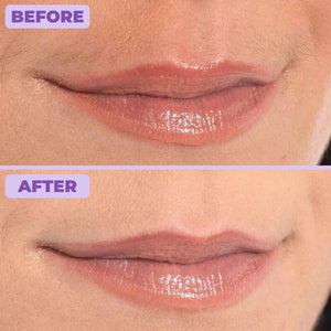 Nurea™ Facial Hair Removal Cream