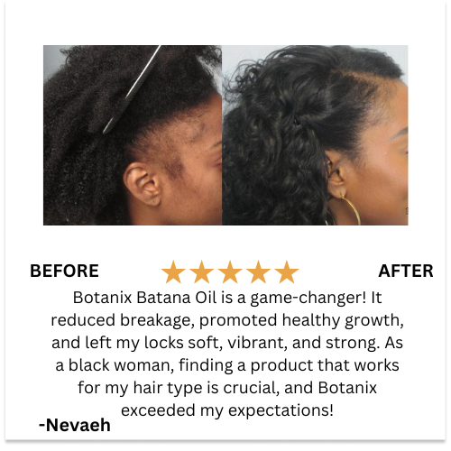 (BUY 1 GET 2) Batana Natural Hair Growth Oil