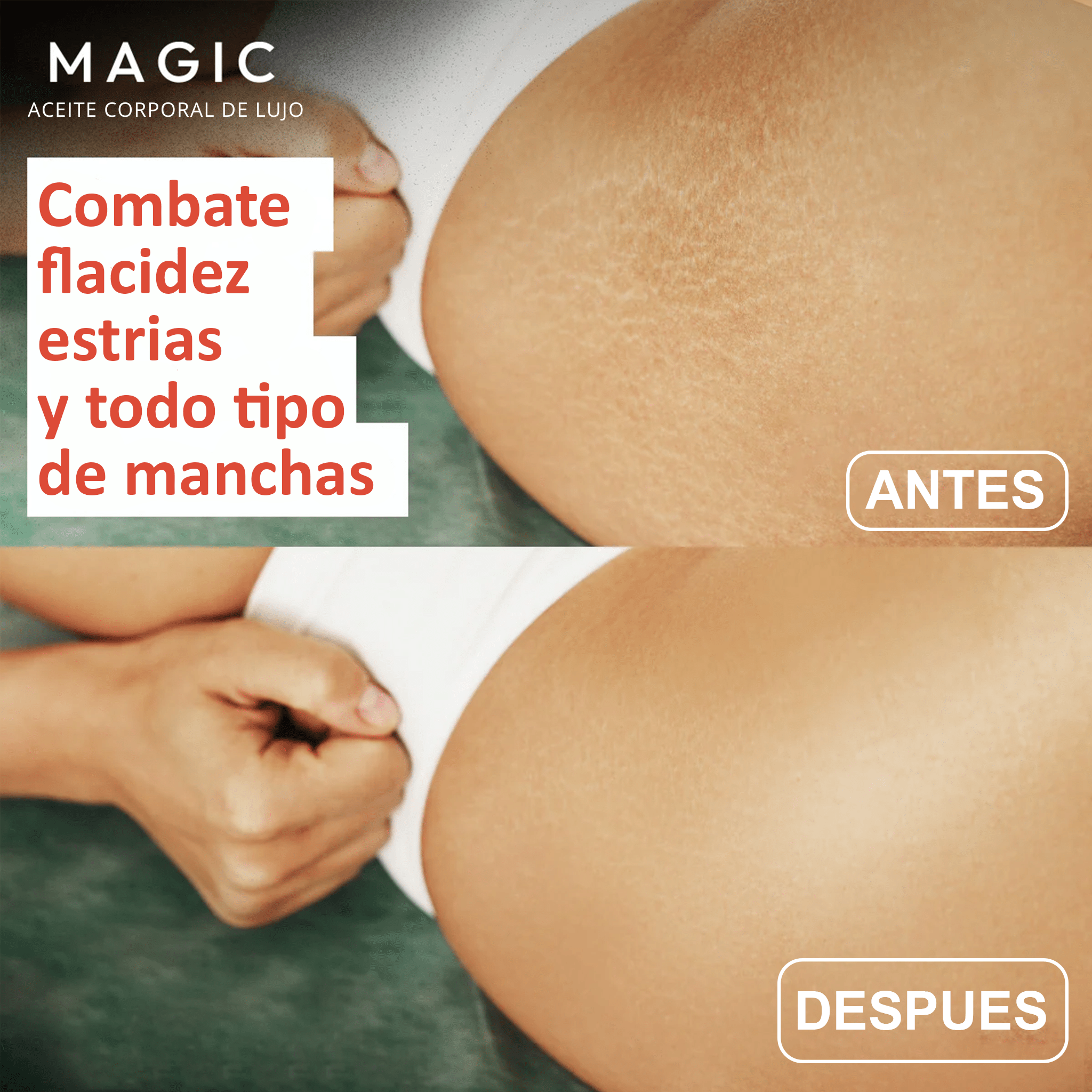 Aceite Original Corporal Magic™