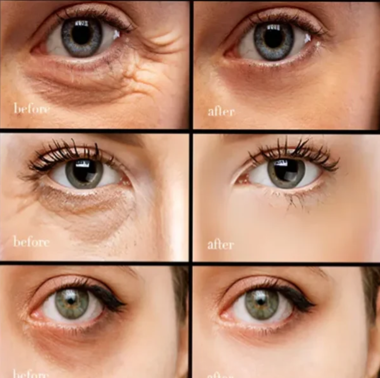 (BUY 1 GET 2)【Black Friday,50 %off,】Caffeine eye cream