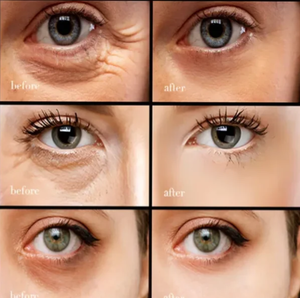 (BUY 1 GET 2)【Black Friday,50 %off,】Caffeine eye cream